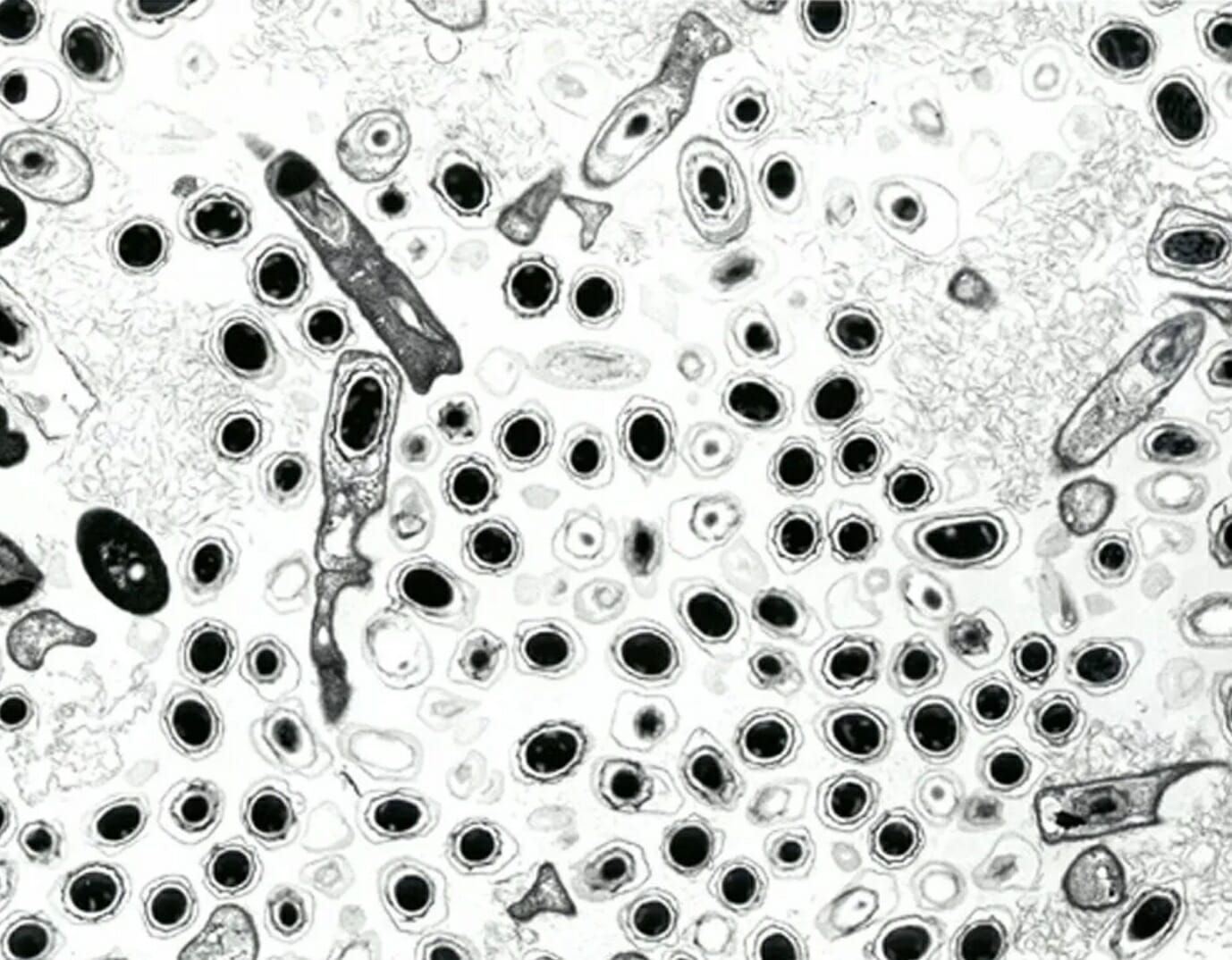 Легочная язва. Сибирская язва бактерия. Сибирская язва в микроскопе. Возбудитель сибирской язвы под микроскопом.