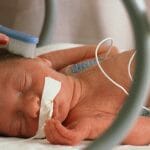 Baby in incubator